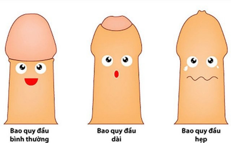 Bao nhiêu tuổi thì cắt bao quy đầu? Cắt bao quy đầu có gây nguy hiểm không? 1