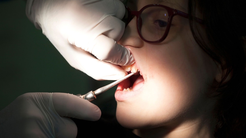 Bao nhiêu tuổi thì hết thay răng? Những điều cần lưu ý để răng vĩnh viễn mọc đều đẹp 3