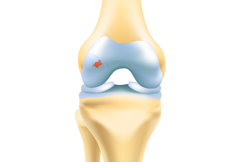 Bảo vệ các mô sụn khớp một cách tối ưu với Condition Joint Kolmar1
