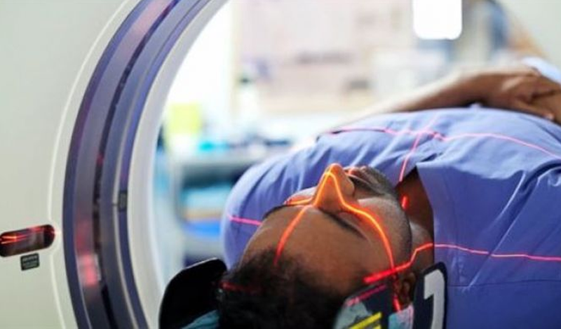 Xạ trị ảnh hưởng đến khả năng sinh sản của bé trai