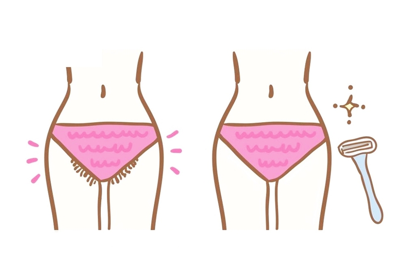 Bật mí cách cạo lông vùng kín không bị ngứa tại nhà 1