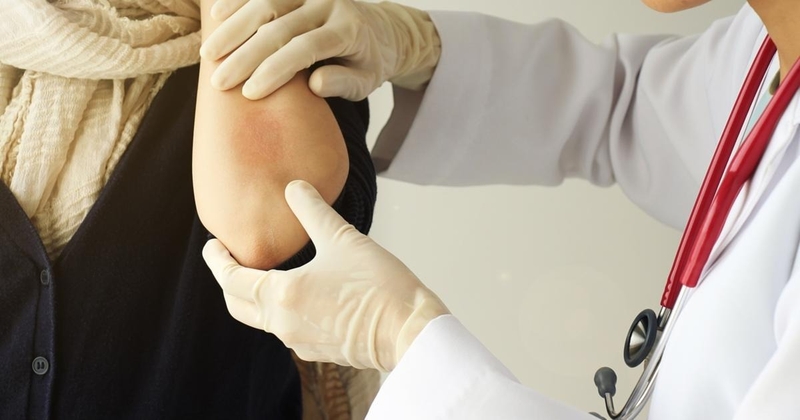 Bật mí cách chữa bệnh hắc lào an toàn, hiệu quả 4