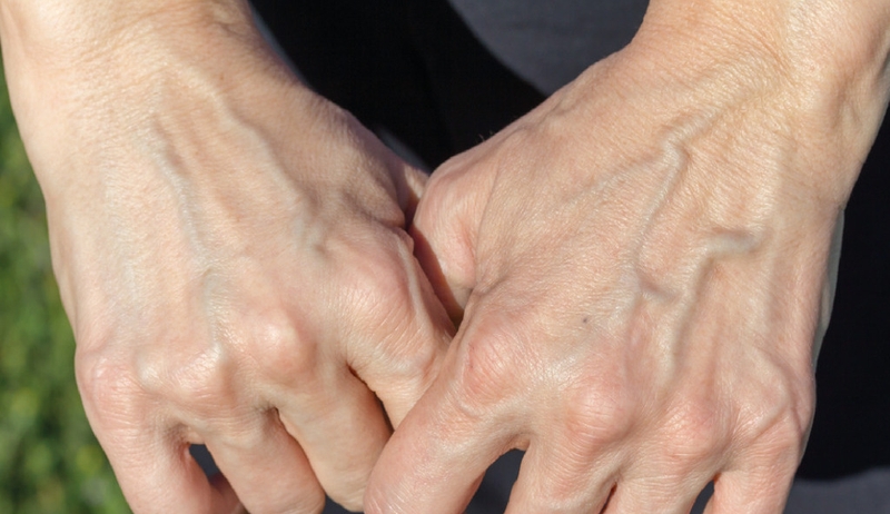 Bật mí một số bài tập giãn tĩnh mạch tay không phải ai cũng biết 1