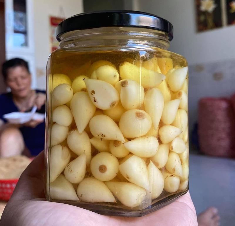 Bật mí một số cách điều trị đau khớp bàn tay vừa hiệu quả, vừa đơn giản1