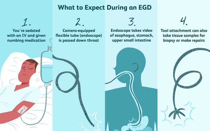 Bật mí ngay: Khám dạ dày ở đâu Hà Nội là tốt nhất? 3