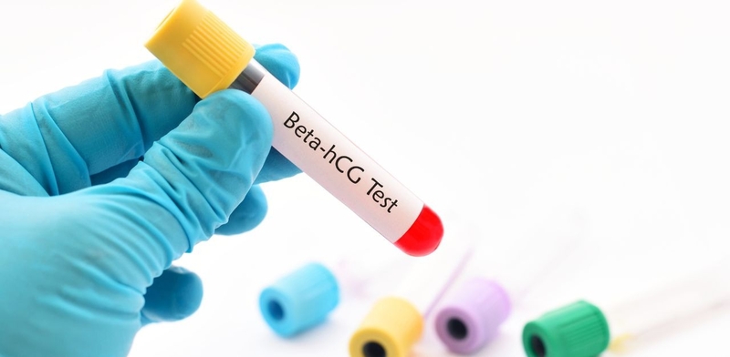 Bật mí ngay: Xét nghiệm Beta HCG bao lâu có kết quả? 2
