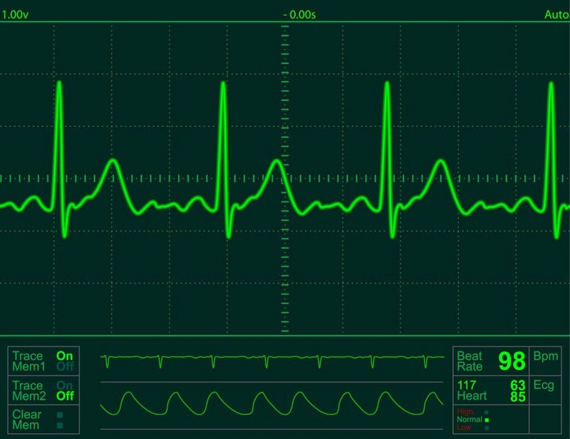 Bật mí nguyên nhân hồi hộp do bệnh về tim không phải ai cũng biết 4