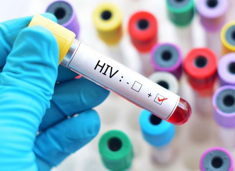 Bất ngờ phơi nhiễm HIV phải xử lý khẩn cấp như thế nào 3