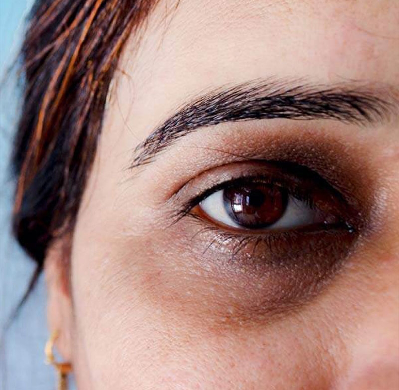 Bất ngờ với hiệu quả của cách trị quầng thâm mắt bằng thìa1