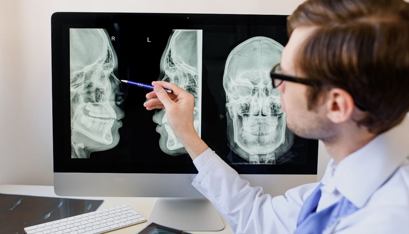 Bất sản xương mũi: Nguyên nhân, triệu chứng và cách điều trị hiệu quả 1