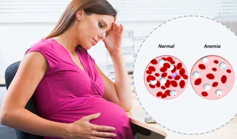 Bầu ăn bánh flan được không? Cách làm flan bổ dưỡng cho mẹ bầu tại nhà 2