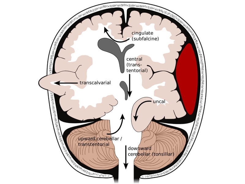 Bầu ăn dưa lưới được không? Một số điều mẹ bầu cần lưu ý khi ăn dưa lưới 3
