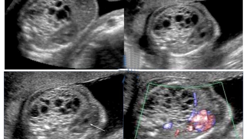 Bầu ăn rau bina được không? Những lợi ích mà rau bina mang lại cho bà bầu 4