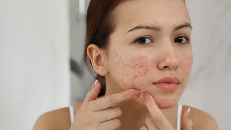 Mẹ bầu có dùng được mặt nạ đất sét không 3