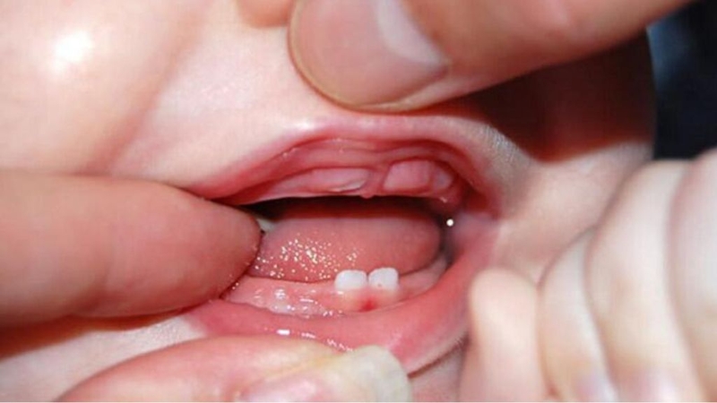 Bé 15 tuần tuổi: Đặc điểm phát triển và cách chăm sóc 2