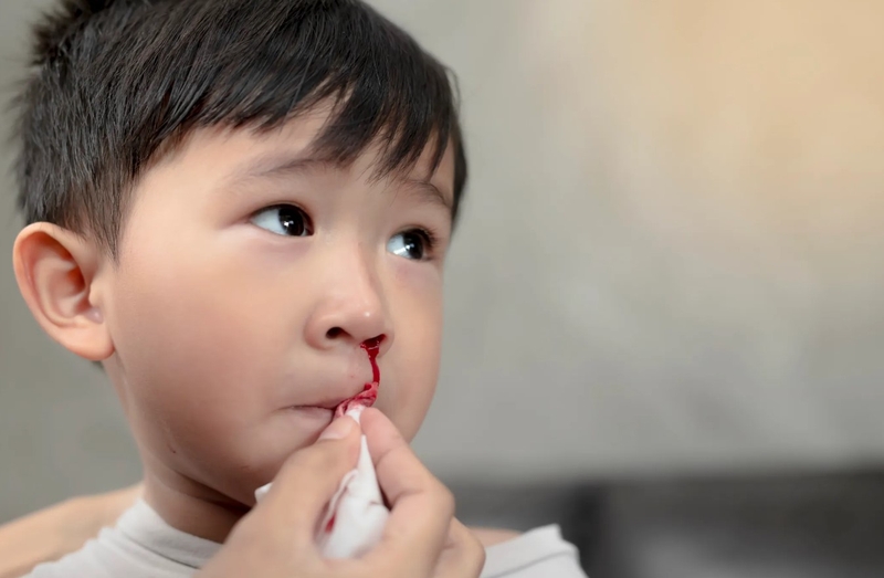 Bé bị chảy máu mũi 1 bên do đâu và xử lý như thế nào? 1