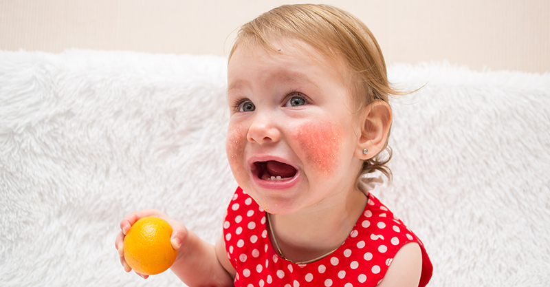 Bé bị phát ban nhưng không sốt có nguy hiểm không và những cách xử lý mẹ cần biết