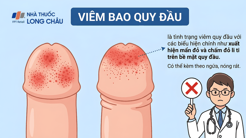 Viêm bao quy đầu gây đau đớn và sưng đỏ