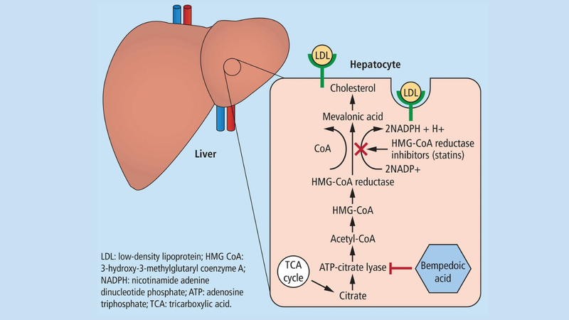 Bempedoic Acid hỗ trợ làm giảm Cholesterol LDL 3