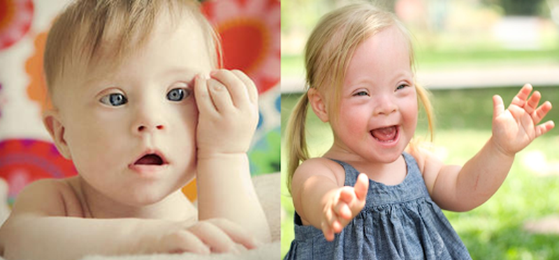 Bệnh bạch cầu cấp dòng lympho ở trẻ em - những yếu tố nguy cơ 1