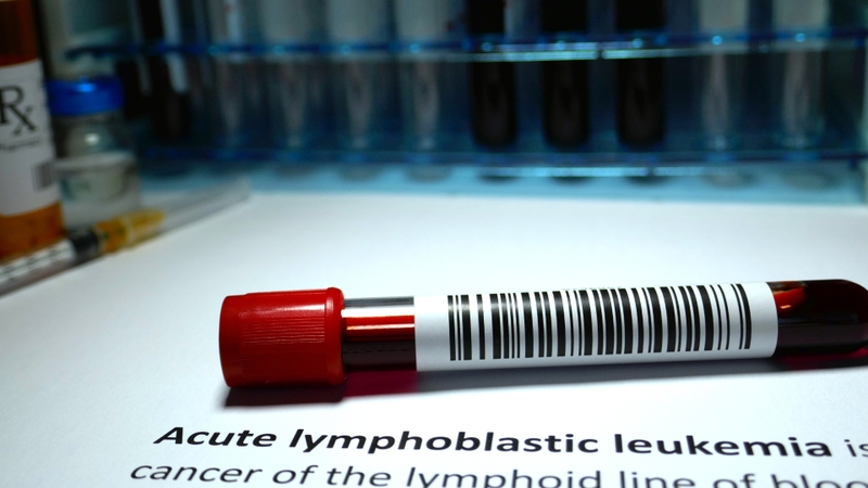 Bệnh bạch cầu lymphoblastic cấp tính và những điều bạn cần biết 1