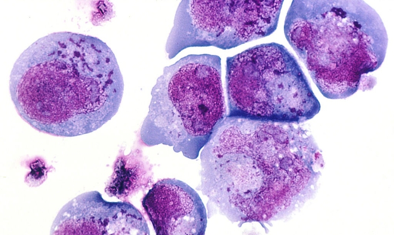 Bệnh ban đào: Nguyên nhân, triệu chứng, cách điều trị 1