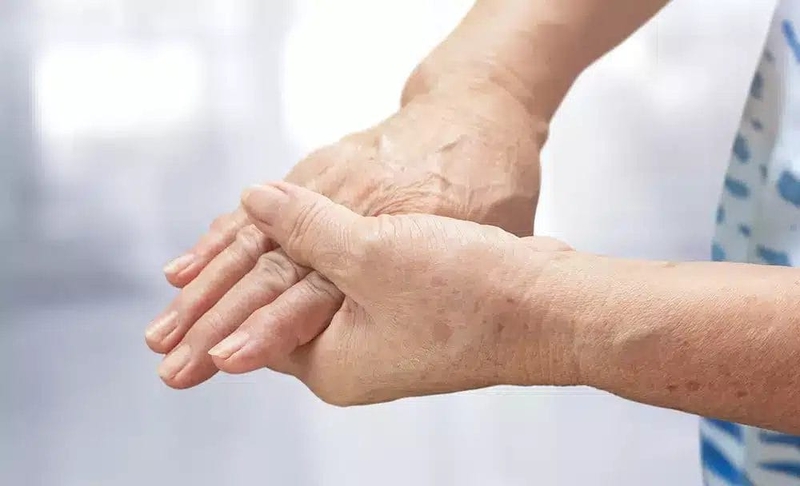 Bệnh beriberi là gì? Nguyên nhân, triệu chứng và phương pháp điều trị 1