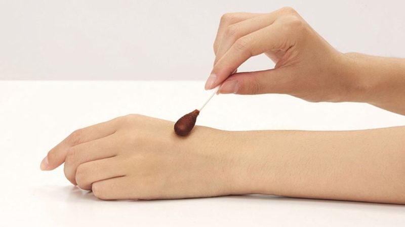 Bệnh chốc lở bao lâu thì khỏi? Cần lưu ý gì trong quá trình điều trị bệnh 6