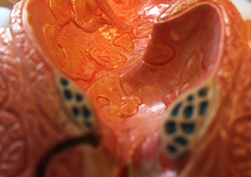 Bệnh Crohn là bệnh gì? Nguyên nhân gây bệnh và cách điều trị hiện nay 2