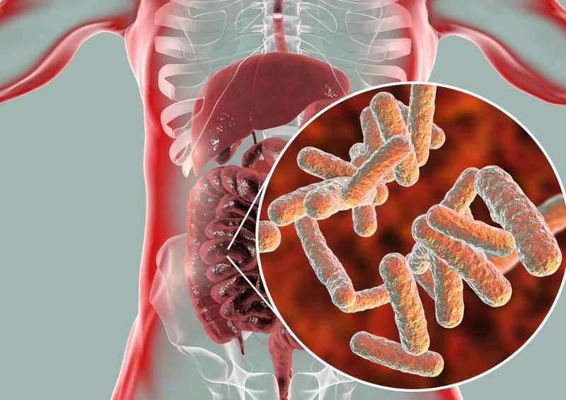 Bệnh Crohn là gì, bệnh crohn có chữa được không? 2