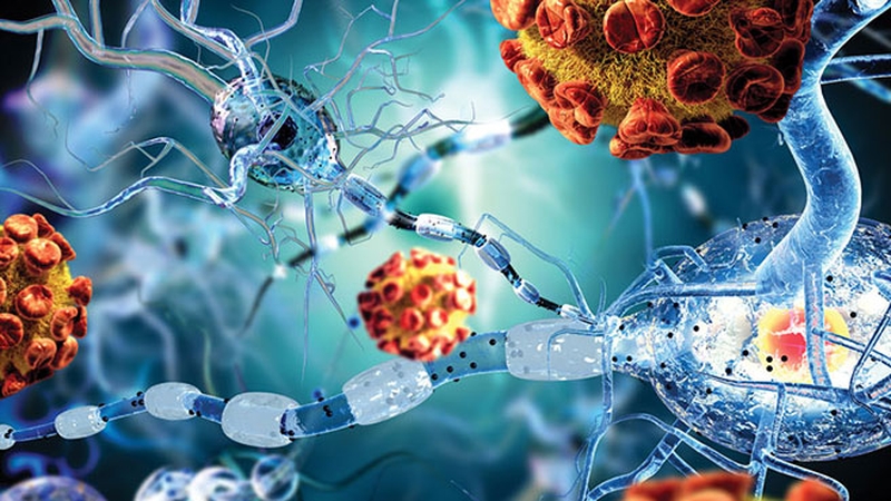 Hệ miễn dịch suy yếu là một trong những nguyên nhân gây ra bệnh Crohn ở người lớn