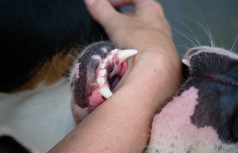 Bệnh dại phát triển trong cơ thể con người như thế nào 2