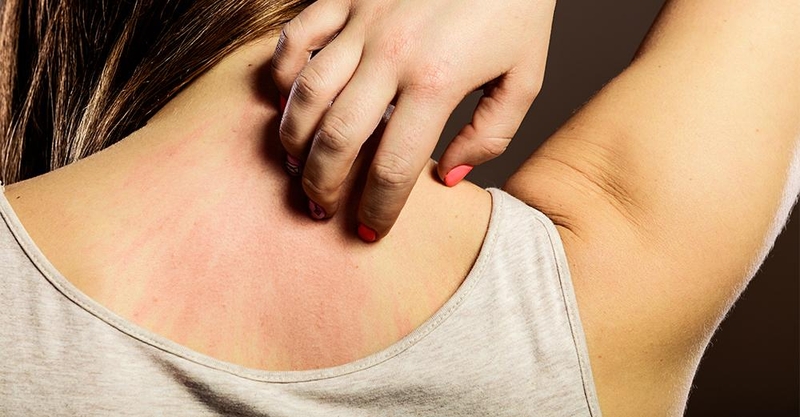 Đi tìm đáp án cho căn bệnh dị ứng bẩm sinh