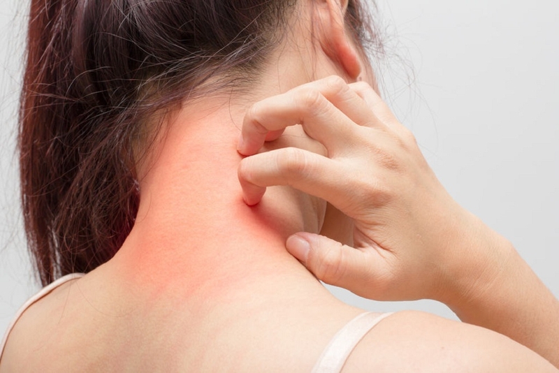 5 con đường gây ra bệnh dị ứng khi tiếp xúc với con người 3