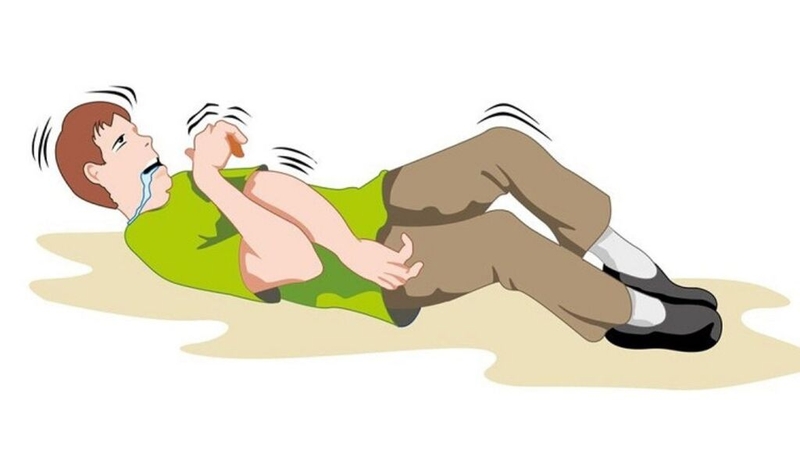 Bệnh động kinh có nguy hiểm không? Triệu chứng và những ảnh hưởng đến sức khỏe 1