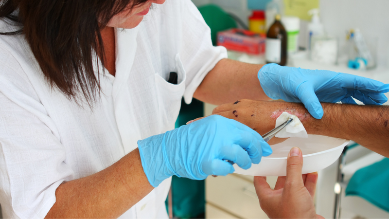 Bệnh Erysypelas là gì? 3