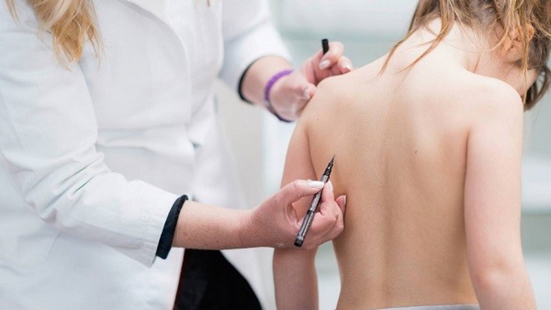 Bệnh gai cột sống có nguy hiểm không 2