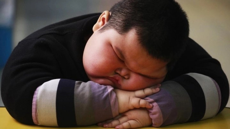 Bệnh gai đen ở người béo phì và những điều bạn cần biết 3