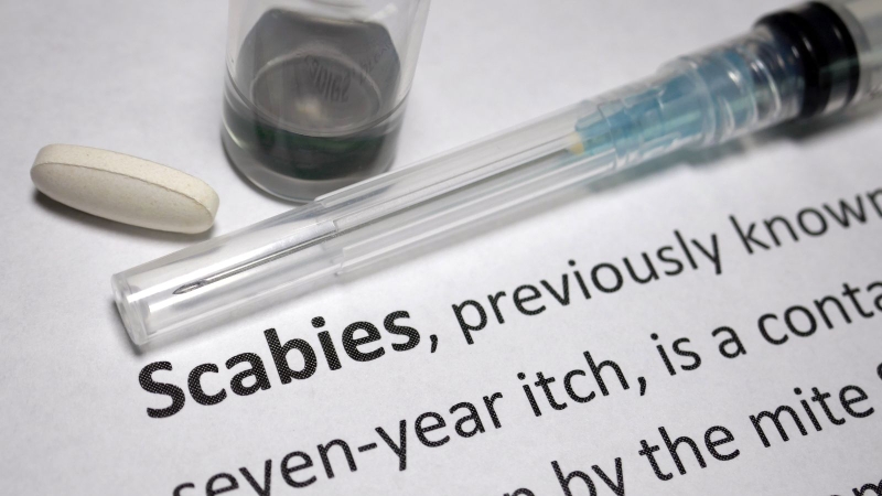 Cơ sở y tế cung cấp hướng dẫn điều trị và phòng ngừa bệnh ghẻ diện rộng