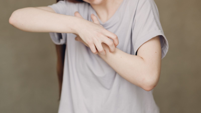 Xuất hiện các cơn ngứa dữ dội và kéo dài không dứt trên da