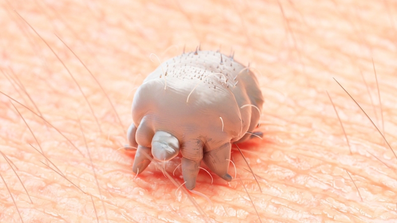 Bệnh ghẻ nước là gì? Nguyên nhân, dấu hiệu và cách điều trị hiệu quả 1