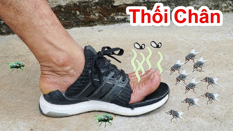 bệnh hôi chân có lây không 2