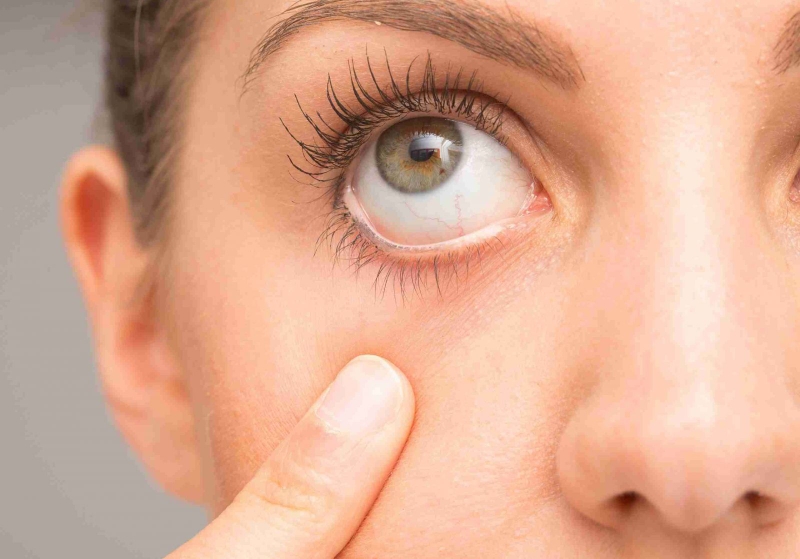 Bệnh khô mắt có nguy hiểm không? Có tác động gì với sức khỏe