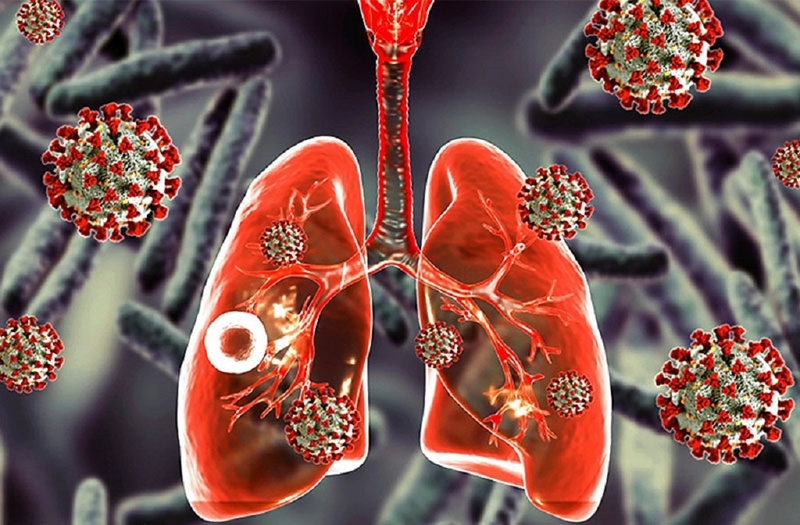 Bệnh lao hô hấp có nguy hiểm không? Phương pháp điều trị như thế nào? 1