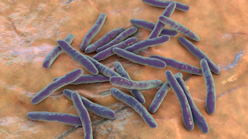 Nguyên nhân bị bệnh lao kháng thuốc có thể do biến đổi của vi khuẩn lao