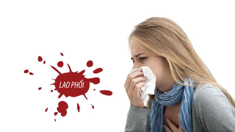 Bệnh lao phổi có lây không? Lây qua con đường nào?1