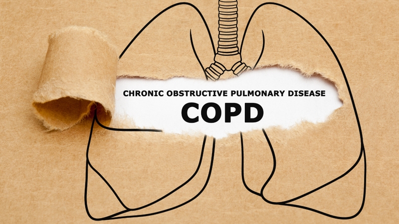 Di chứng sau khi điều trị lao phổi  4