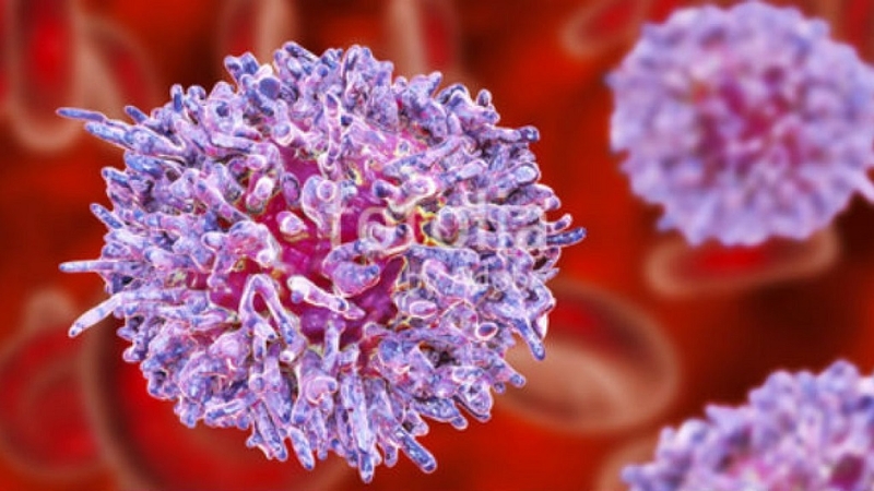 Bệnh leukemia là gì? Cách chẩn đoán và điều trị bệnh leukemia thế nào? 3