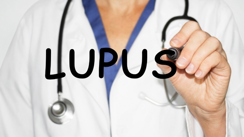 Bệnh lupus ban đỏ giai đoạn cuối hiện nay không thể điều trị khỏi hoàn toàn