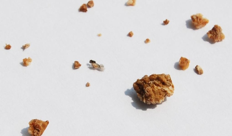 Bệnh lý sỏi tiết niệu và những hệ quả không lường 2